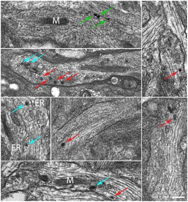Nano-pulling stimulates axon regeneration in dorsal root ganglia by inducing stabilization of axonal microtubules and activation of local translation