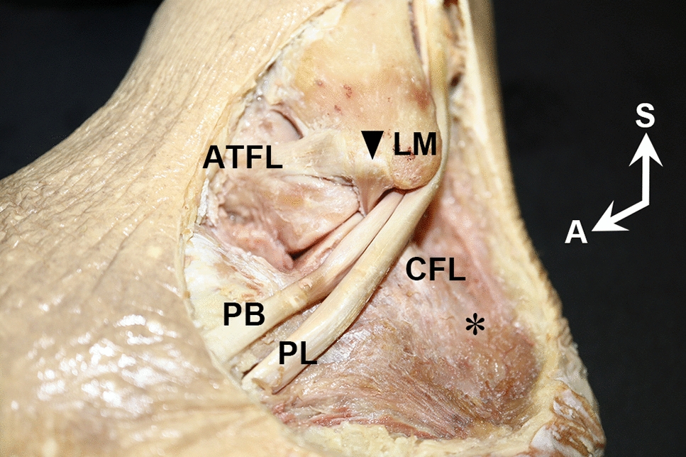 The calcaneofibular ligament groove at the inferior fibula, an ultrasonographic anatomical landmark