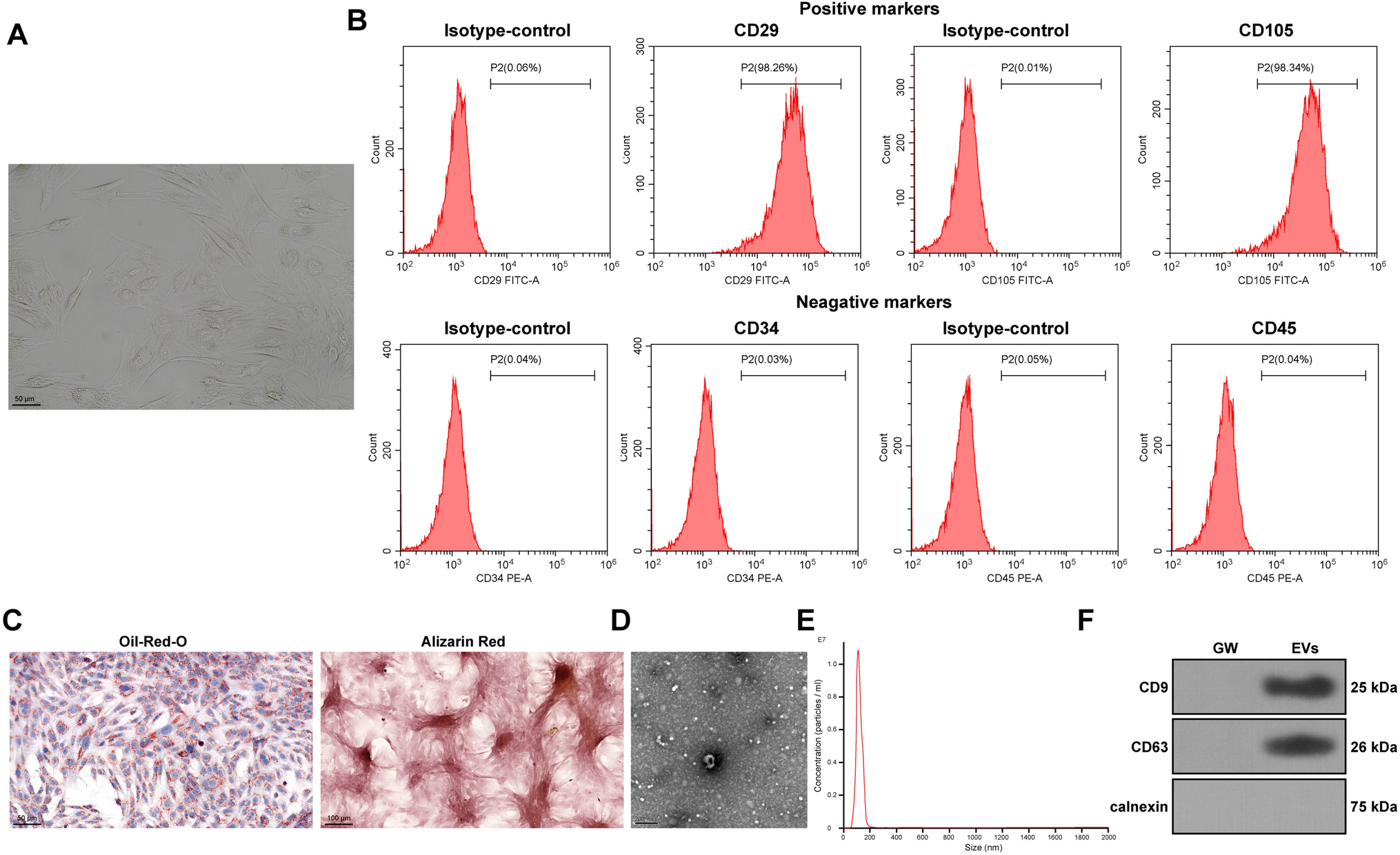 Effects of Mesenchymal Stem Cells-Derived Extracellular Vesicles on Inhibition of Hepatic Fibrosis by Delivering miR-200a