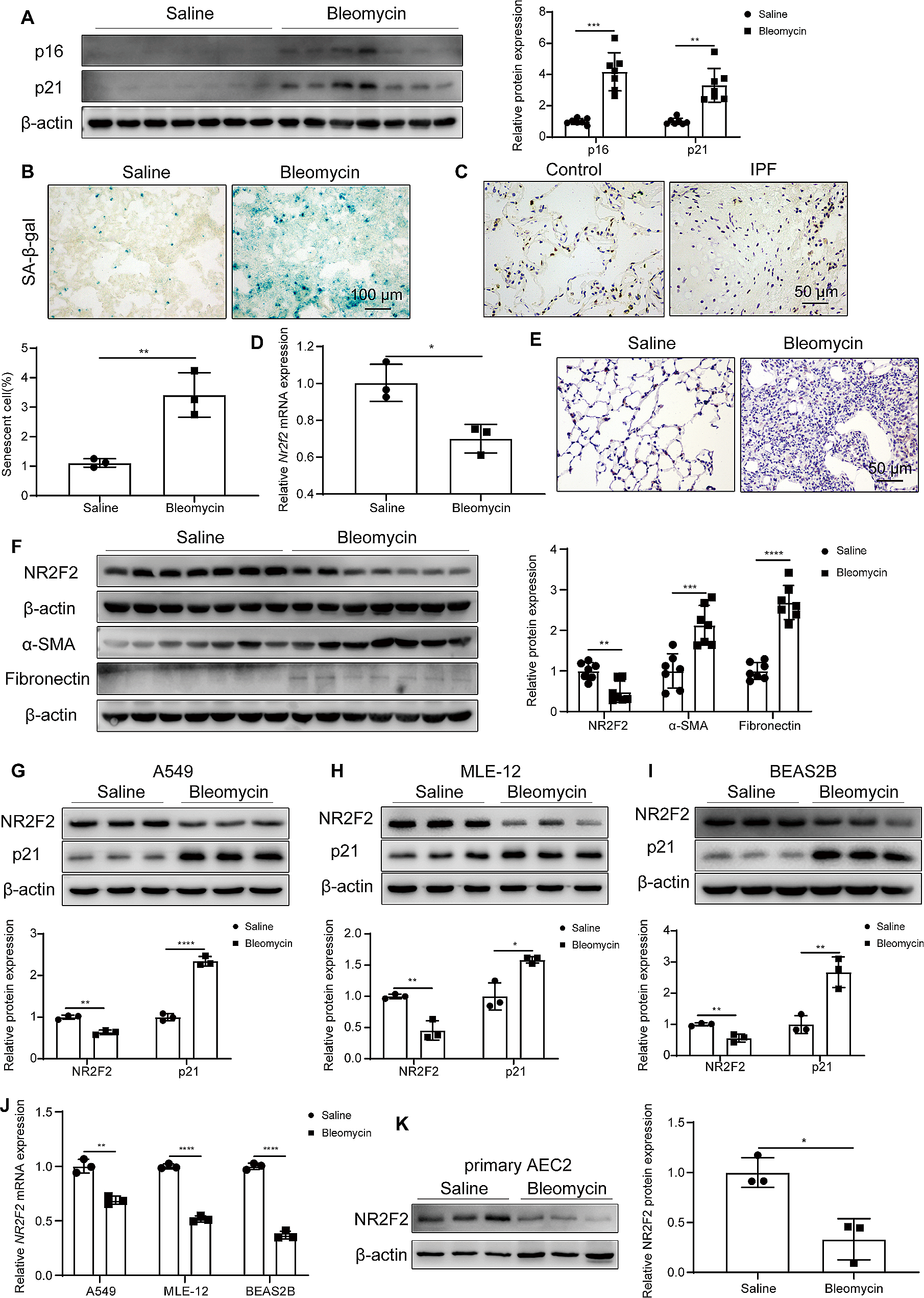 NR2F2 alleviates pulmonary fibrosis by inhibition of epithelial cell senescence