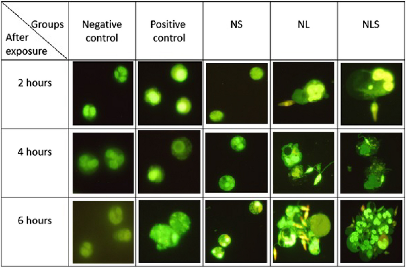 Neutrophil extracellular traps formation: effect of Leishmania major promastigotes and salivary gland homogenates of Phlebotomus papatasi in human neutrophil culture