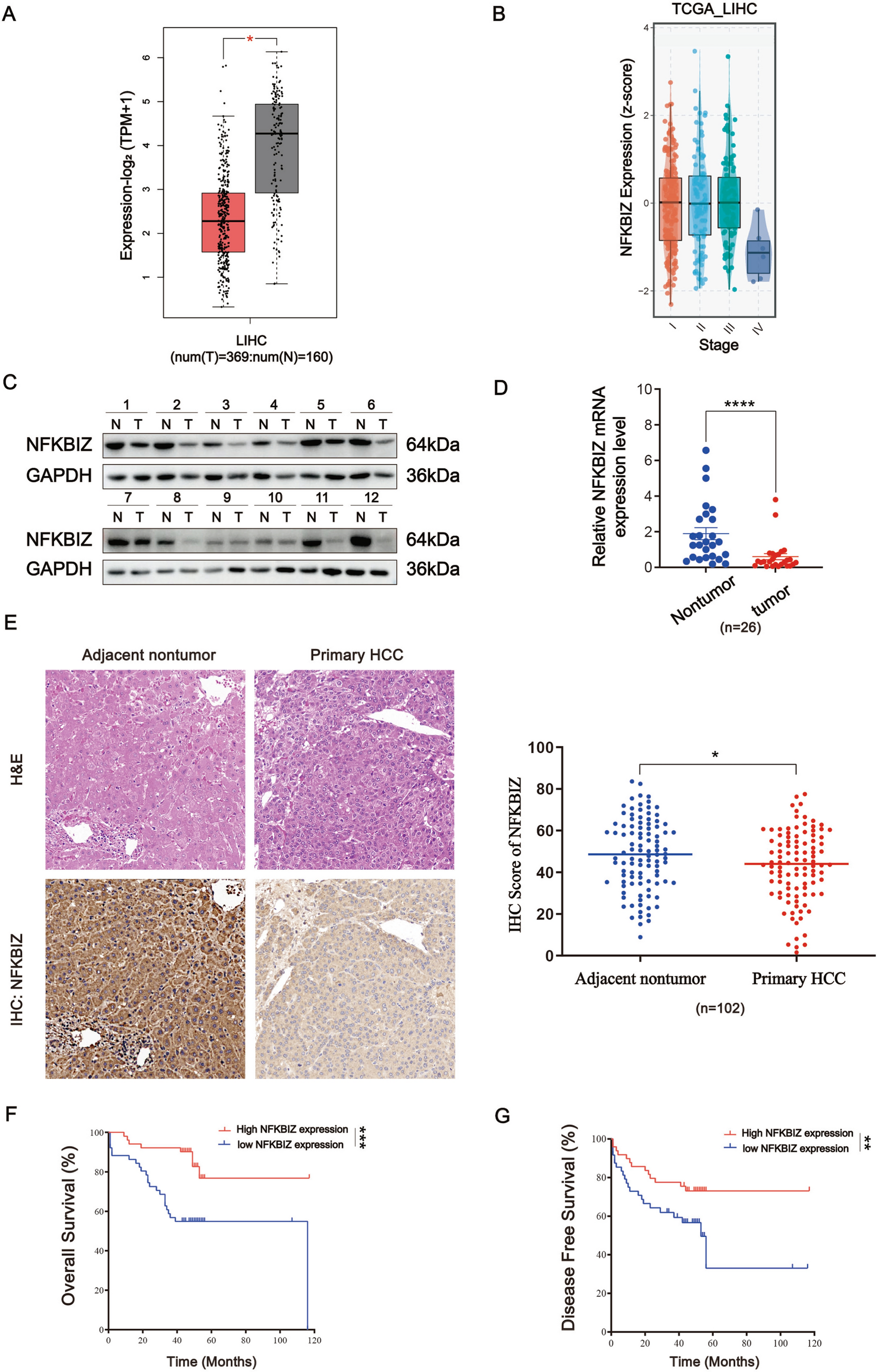 NFKBIZ regulates NFκB signaling pathway to mediate tumorigenesis and metastasis of hepatocellular carcinoma by direct interaction with TRIM16