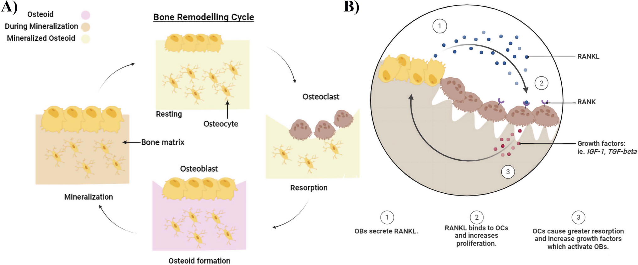 An Overview of Osteoporosis and Possible Treatment Approaches