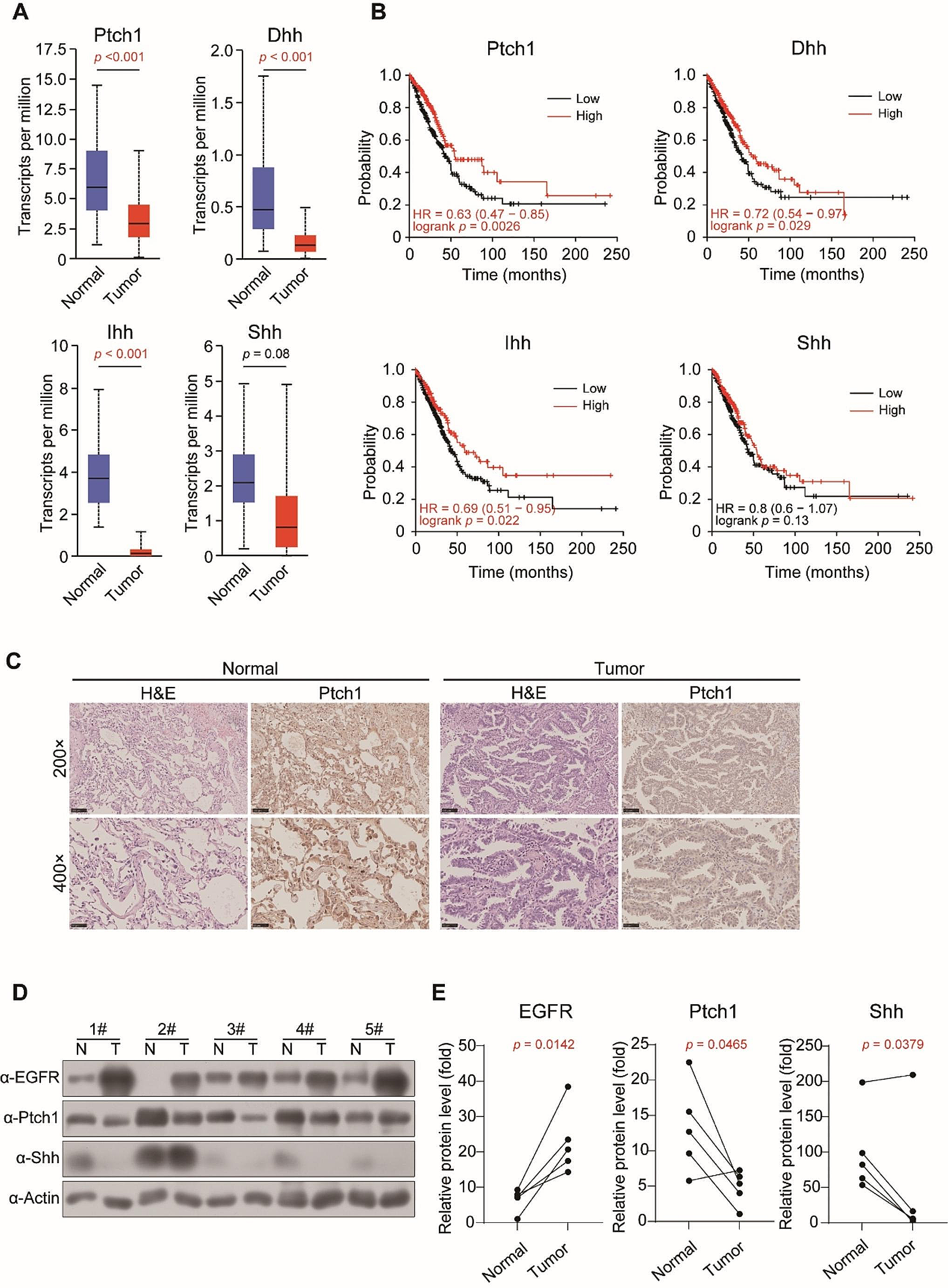 Hedgehog ligand and receptor cooperatively regulate EGFR stability and activity in non-small cell lung cancer