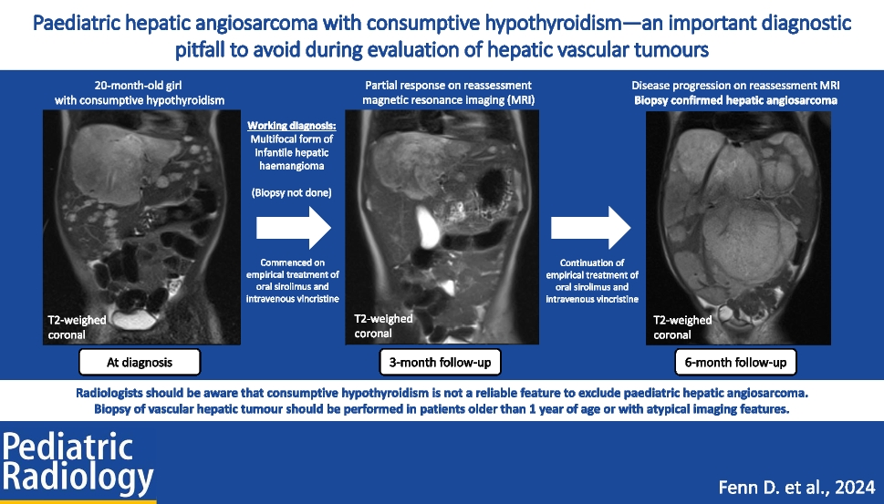 Paediatric hepatic angiosarcoma with consumptive hypothyroidism—an important diagnostic pitfall to avoid during evaluation of hepatic vascular tumours