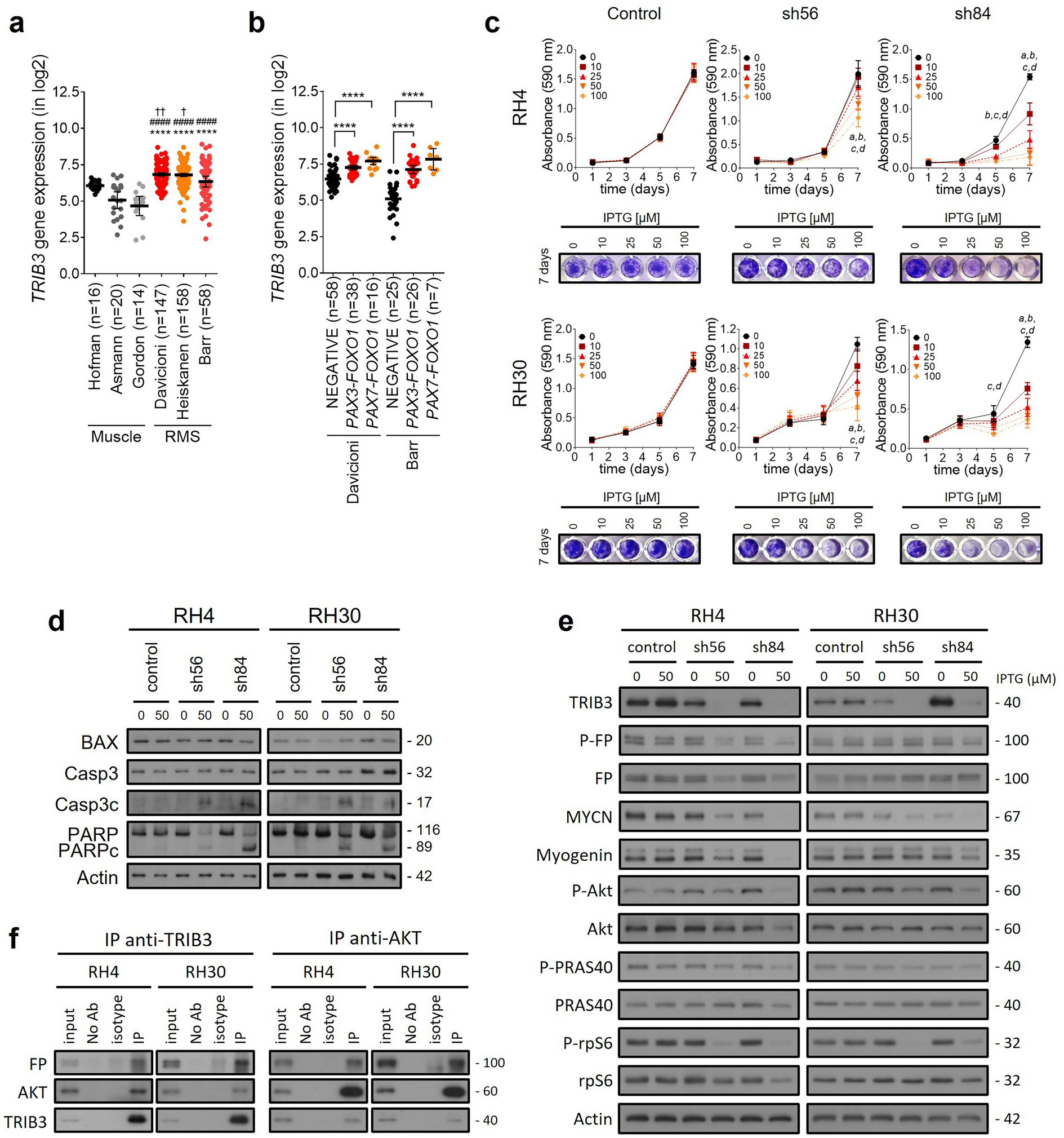 TRIB3 silencing promotes the downregulation of Akt pathway and PAX3-FOXO1 in high-risk rhabdomyosarcoma