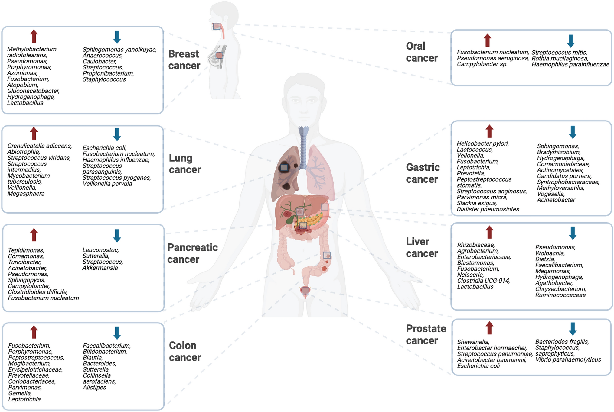 The Microbiome Matters: Its Impact on Cancer Development and Therapeutic Responses