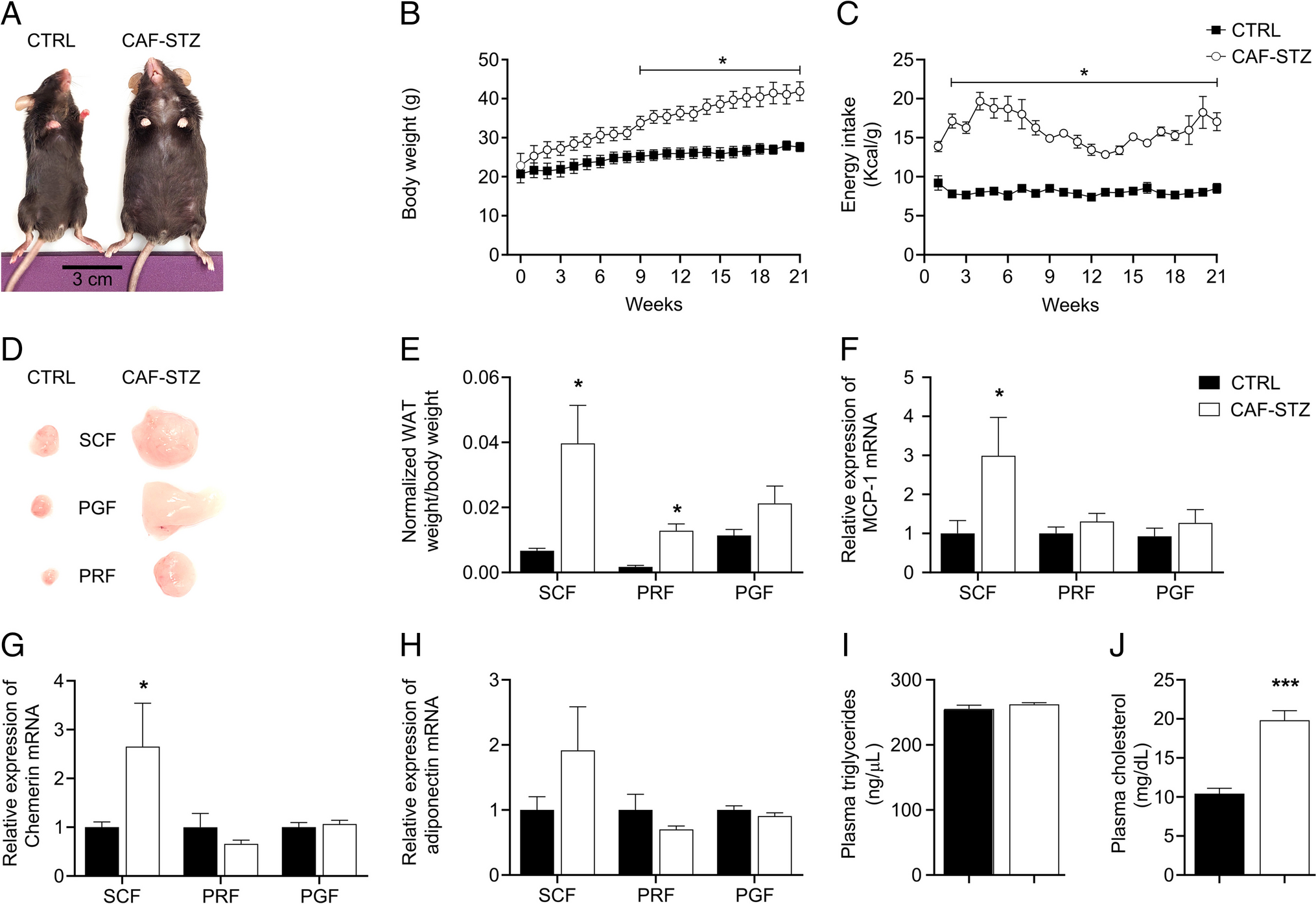 Gene expression alterations of purinergic signaling components in obesity-associated intestinal low-grade inflammation in type 2 diabetes