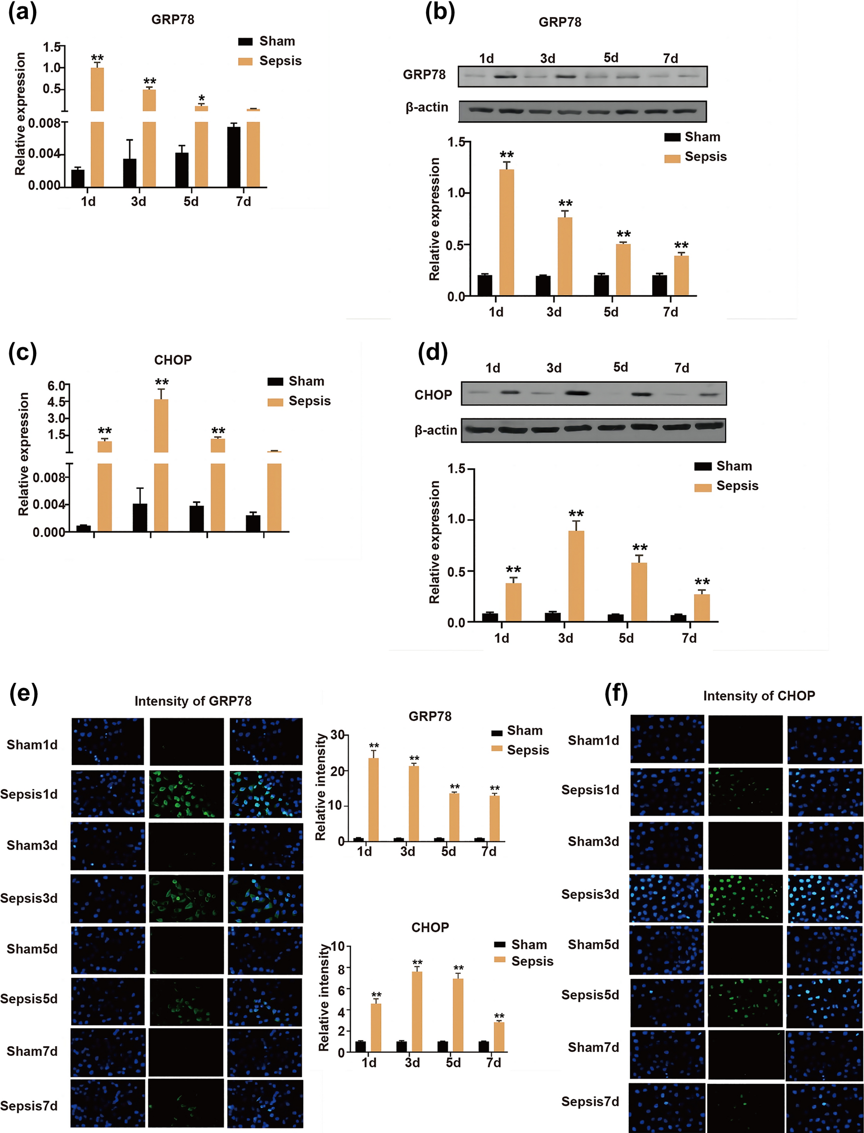 A study on expression of GRP78 and CHOP in neutrophil endoplasmic reticulum and their relationship with neutrophil apoptosis in the development of sepsis