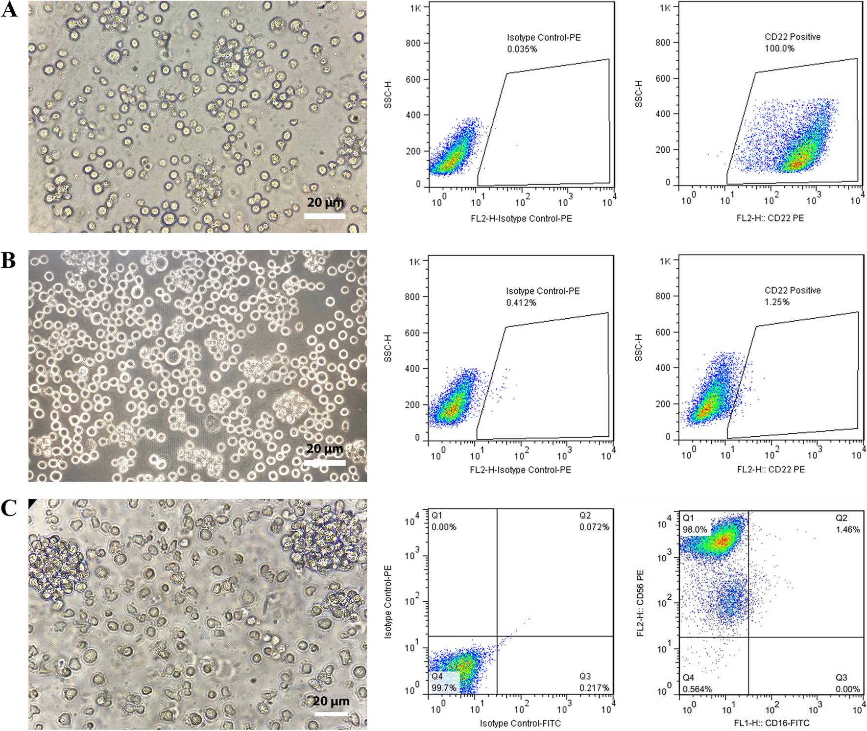 High yield killing of lymphoma cells by anti-CD22 CAR-NK cell therapy