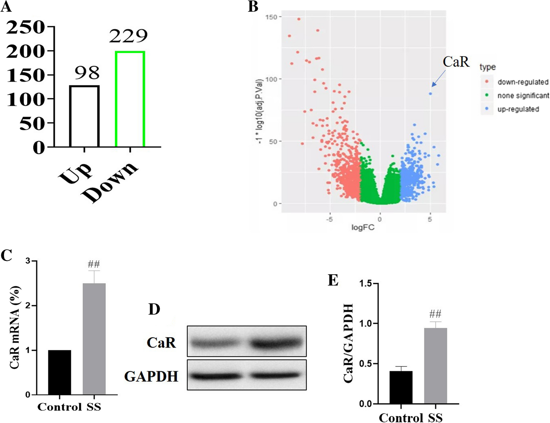 Rutin alleviates Sjogren’s syndrome via CaR/NLRP3/NF-κB signal pathway