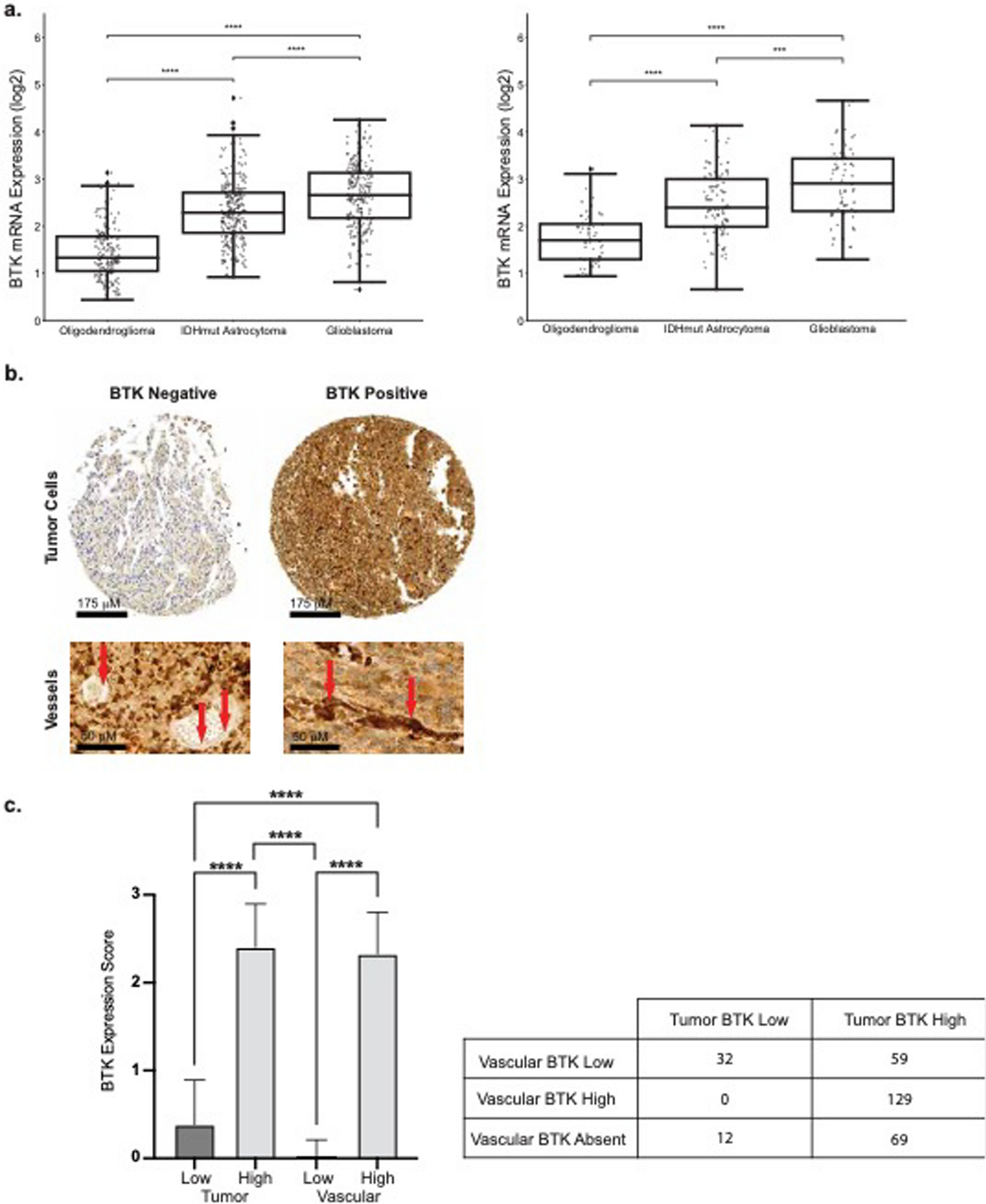 Ibrutinib disrupts blood-tumor barrier integrity and prolongs survival in rodent glioma model