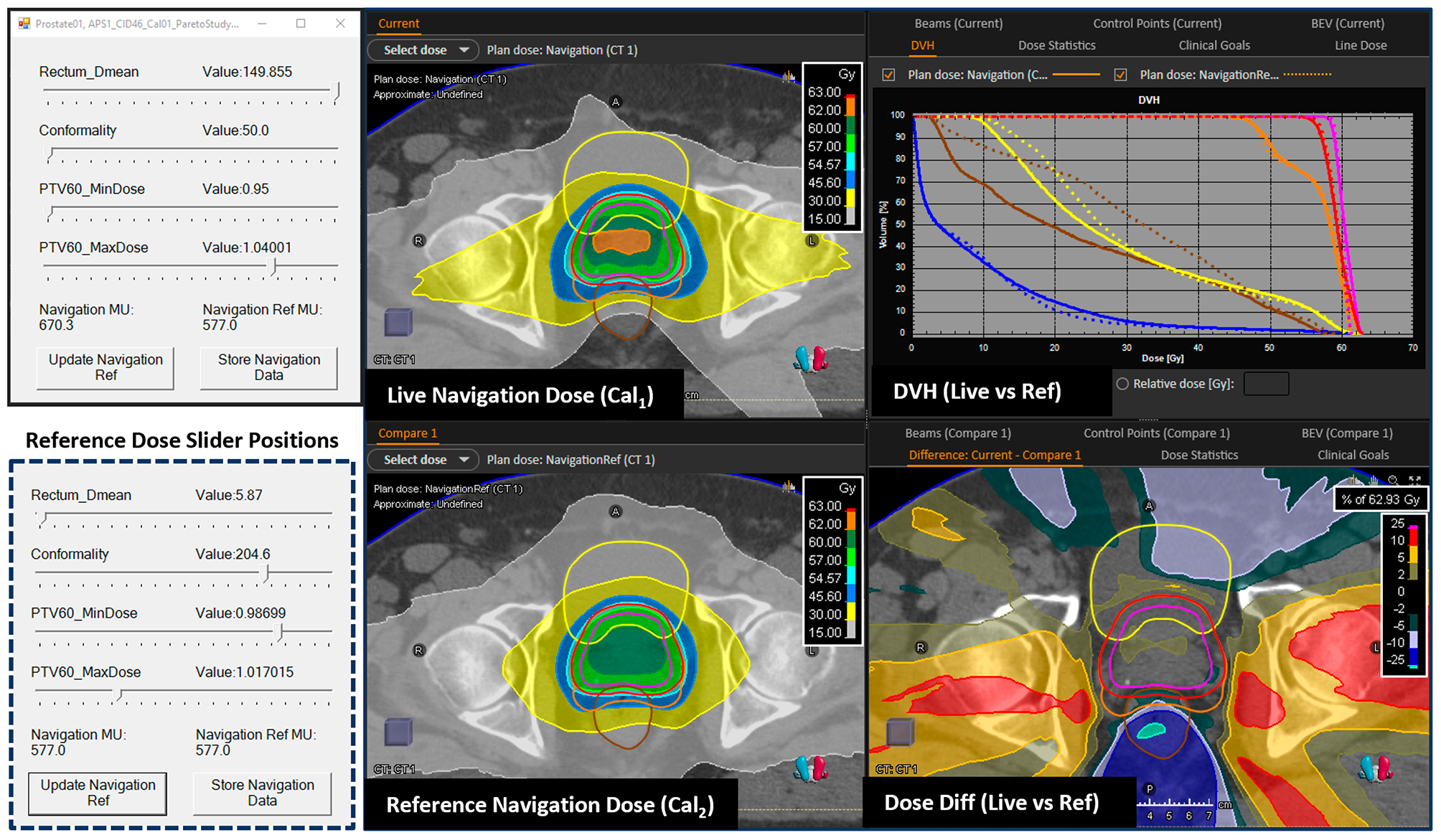 Multi-institutional evaluation of a Pareto navigation guided automated radiotherapy planning solution for prostate cancer