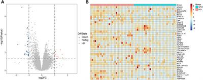 Transcriptomic profile of premature ovarian insufficiency with RNA-sequencing