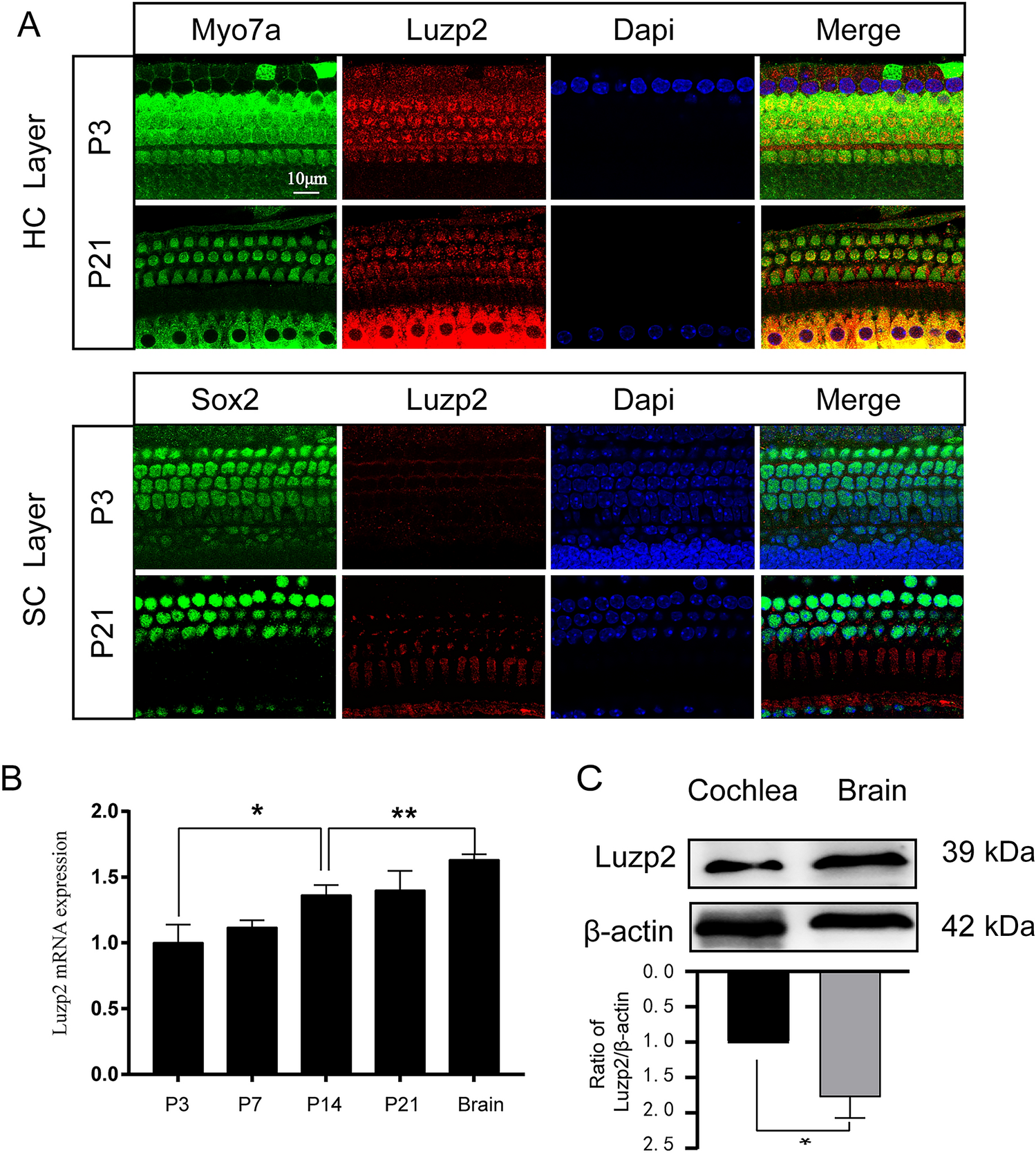 Deletion of Luzp2 Does Not Cause Hearing Loss in Mice