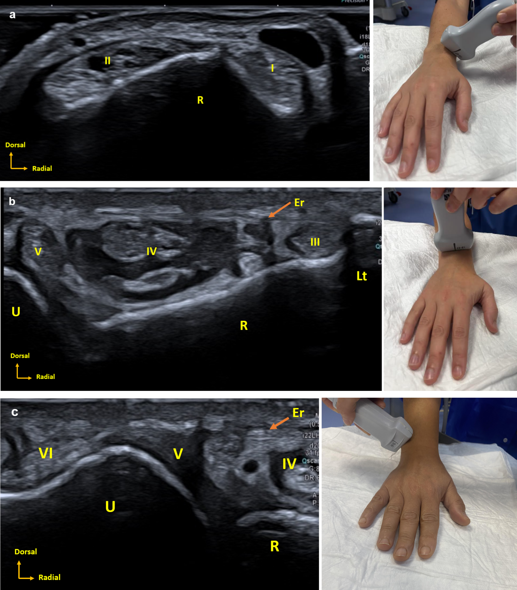Ultrasound identification of hand and wrist anatomical structures by hand surgeons new to ultrasonographic techniques