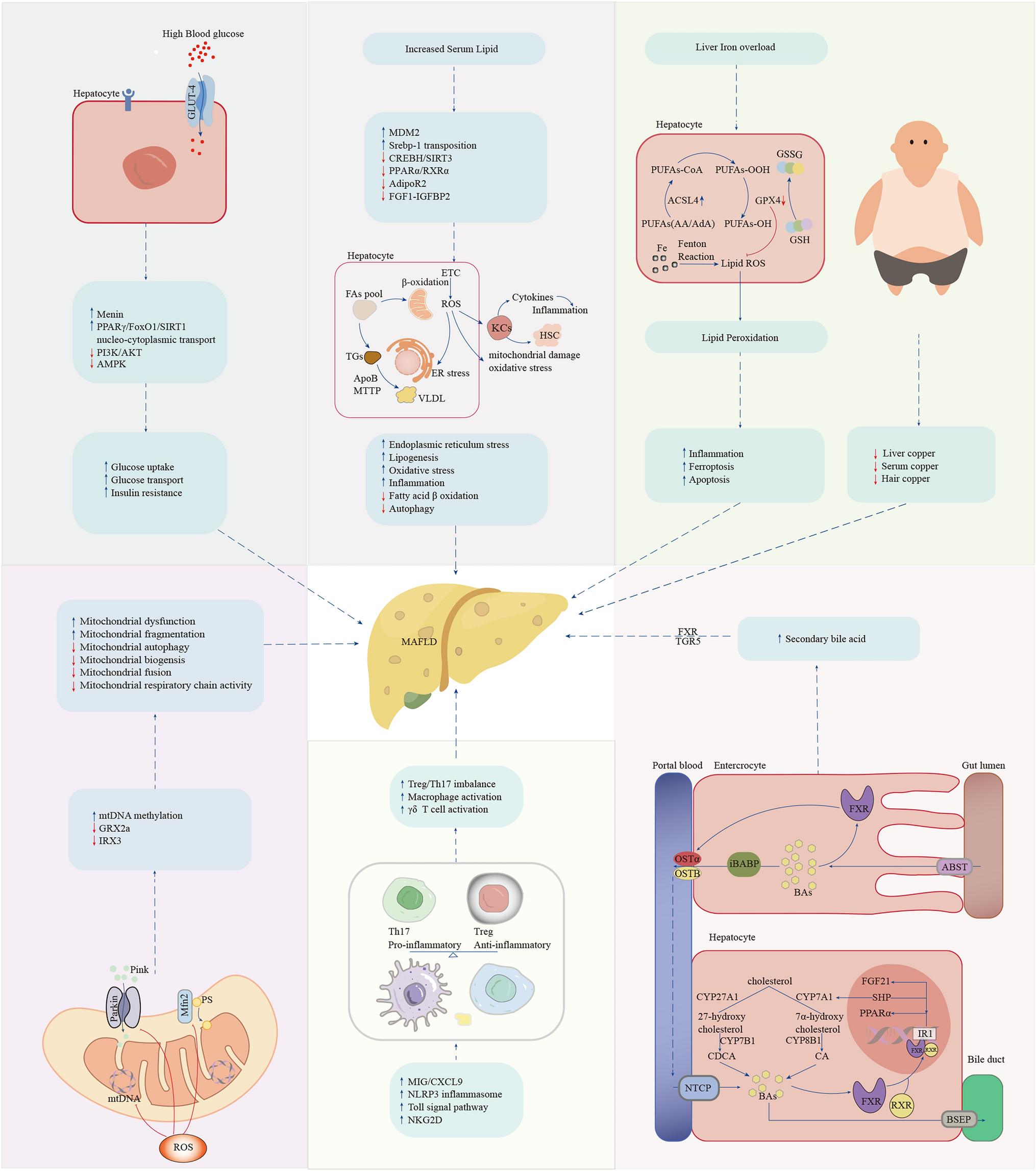MAFLD as part of systemic metabolic dysregulation