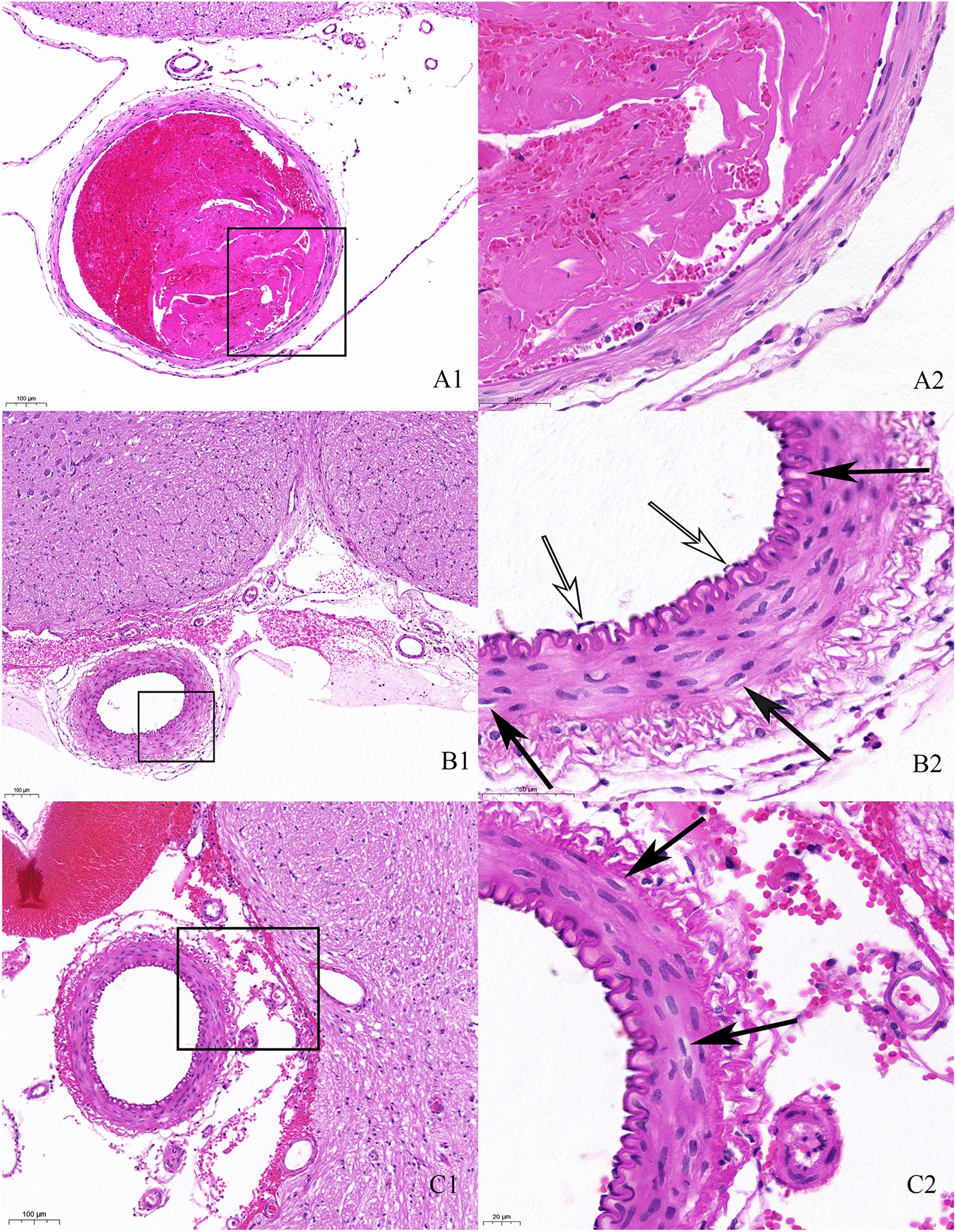 The Impact of Enteral Nimodipine on Endothelial Cell Apoptosis in an Animal Subarachnoid Hemorrhage Model