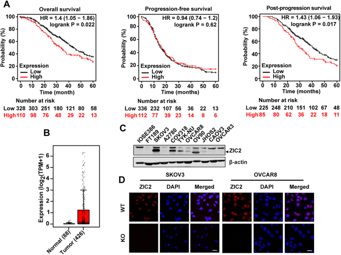 Transcription factor ZIC2 regulates the tumorigenic phenotypes associated with both bulk and cancer stem cells in epithelial ovarian cancer
