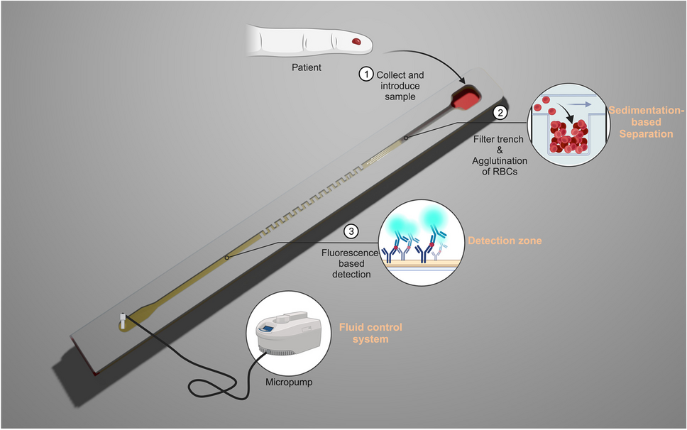 Sample-to-answer lateral flow assay with integrated plasma separation and NT-proBNP detection
