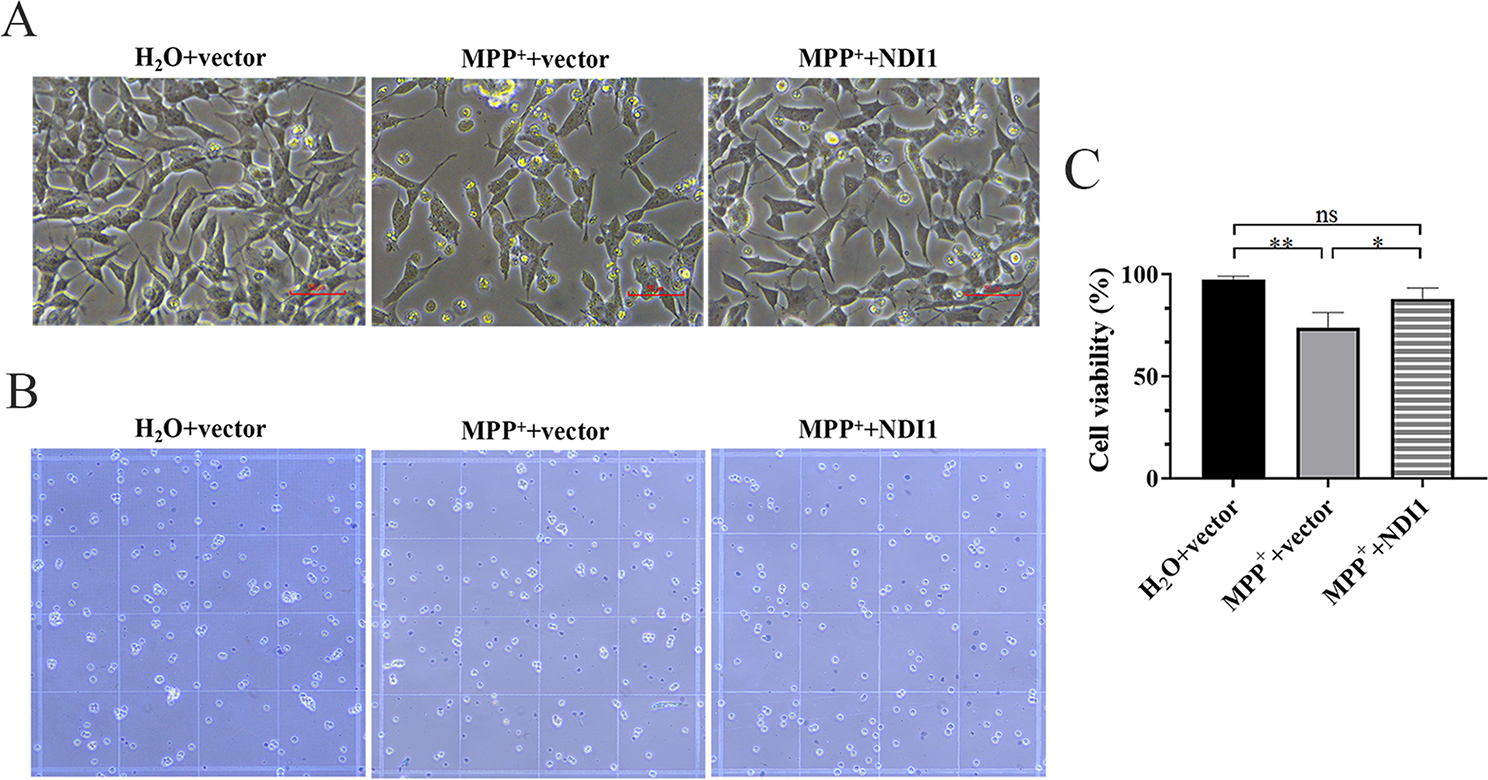 Targeting Mitochondrial Complex I Deficiency in MPP+/MPTP-induced Parkinson’s Disease Cell Culture and Mouse Models by Transducing Yeast NDI1 Gene