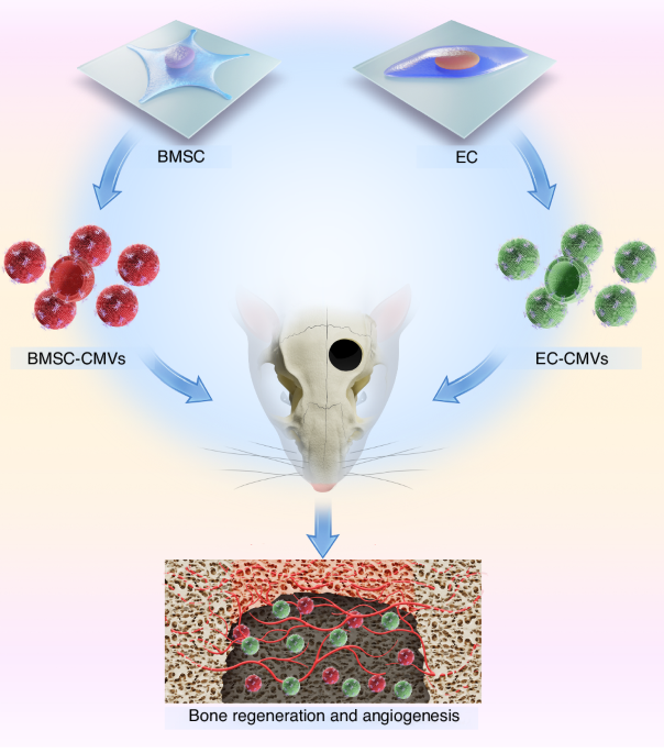 Cell membrane vesicles derived from hBMSCs and hUVECs enhance bone regeneration