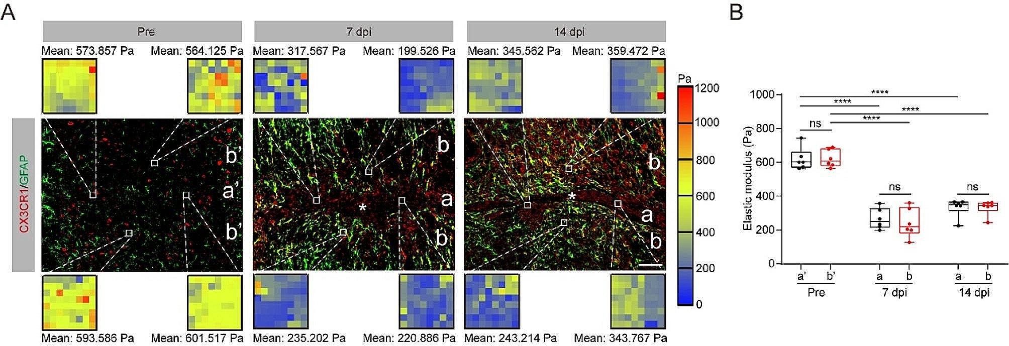 Fascin-1 limits myosin activity in microglia to control mechanical characterization of the injured spinal cord