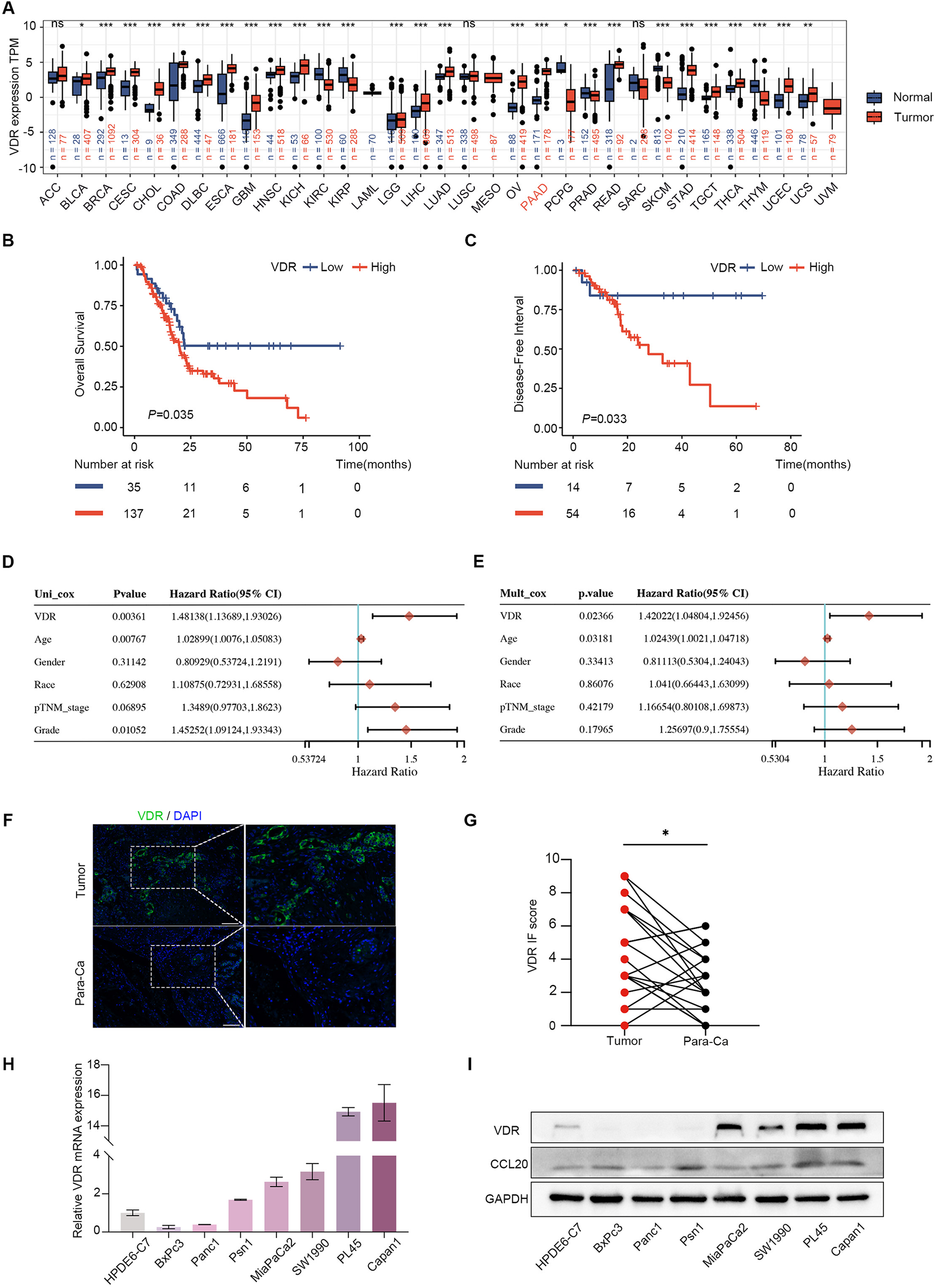 VDR promotes pancreatic cancer progression in vivo by activating CCL20-mediated M2 polarization of tumor associated macrophage