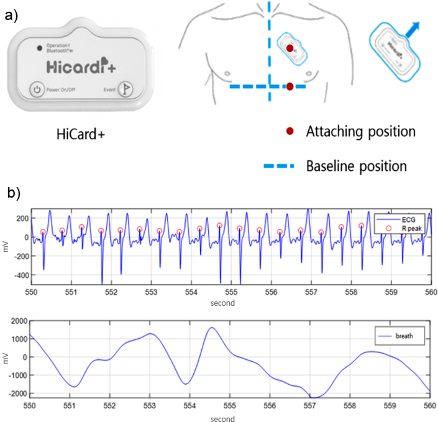 Analysis of breathing patterns to stabilize cardiovascular changes in physical stress environments : inspiration responds to rapid changes in blood pressure
