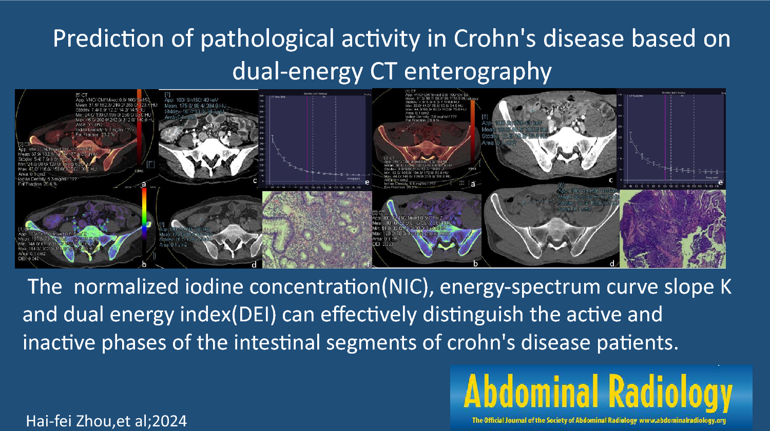 Prediction of pathological activity in Crohn’s disease based on dual-energy CT enterography