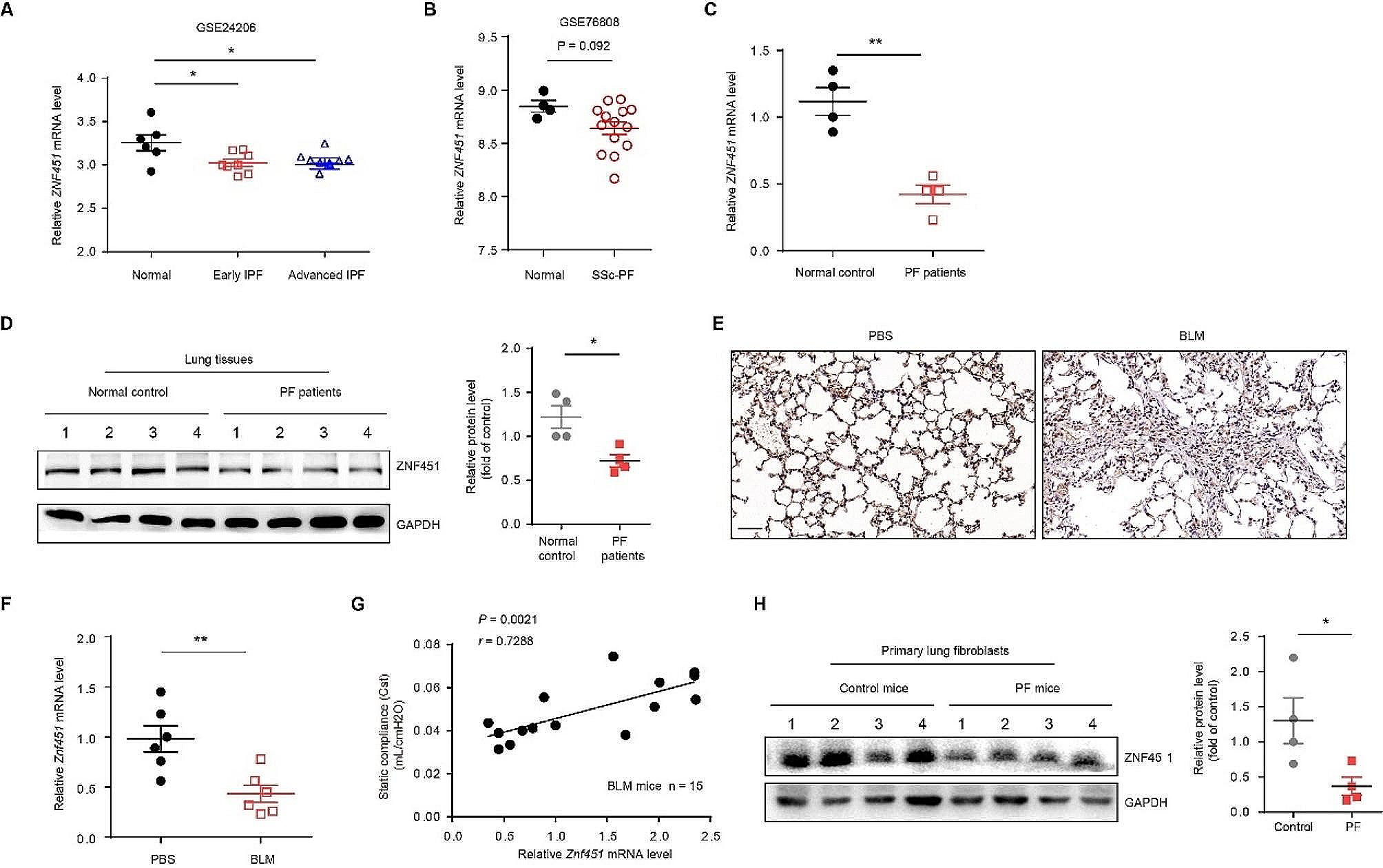 Loss of ZNF451 mediates fibroblast activation and promotes lung fibrosis