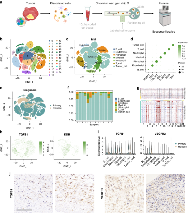 Single-cell sequencing reveals VEGFR as a potential target for CAR-T cell therapy in chordoma