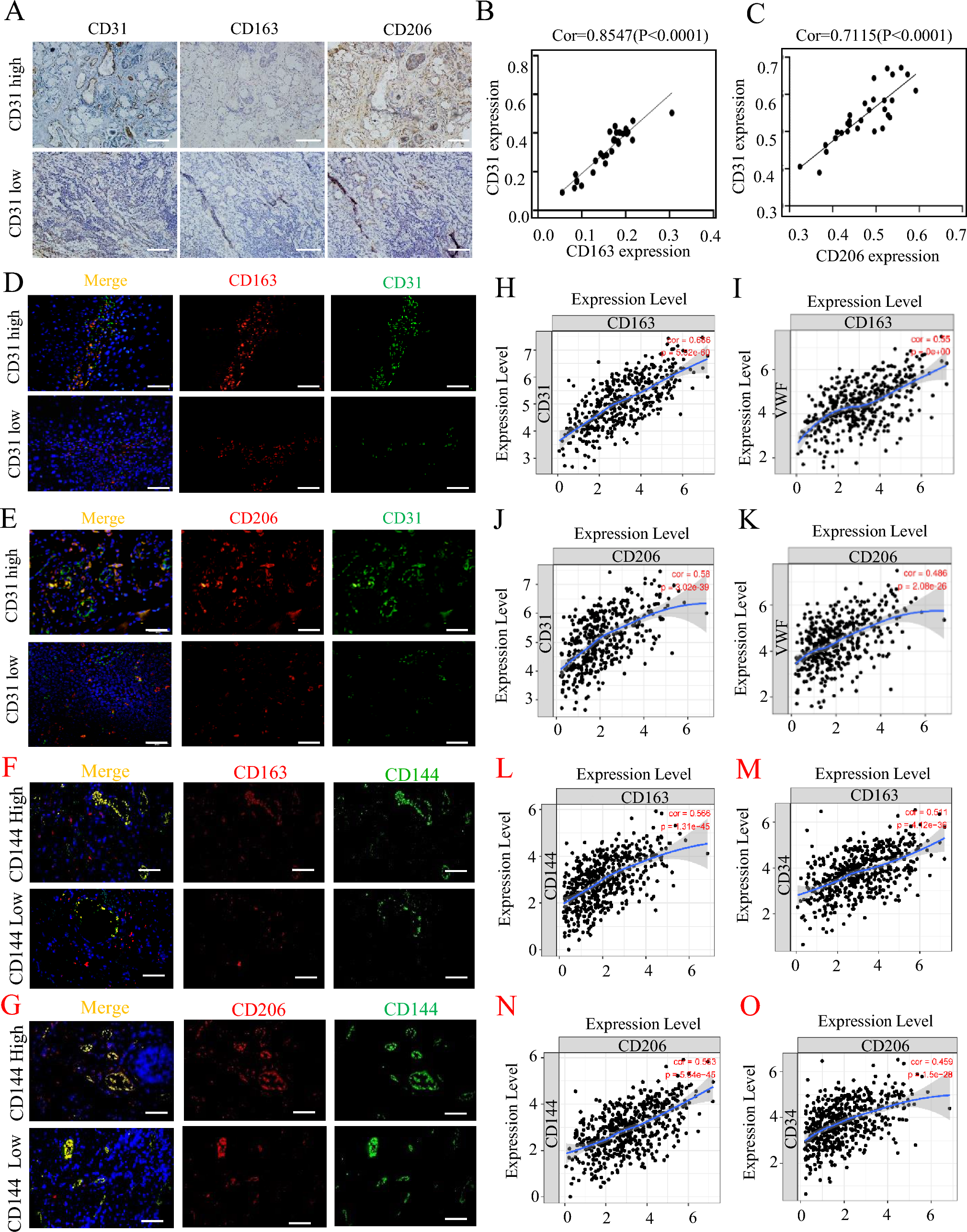 Tumor-associated macrophage-derived exosomal miR21-5p promotes tumor angiogenesis by regulating YAP1/HIF-1α axis in head and neck squamous cell carcinoma
