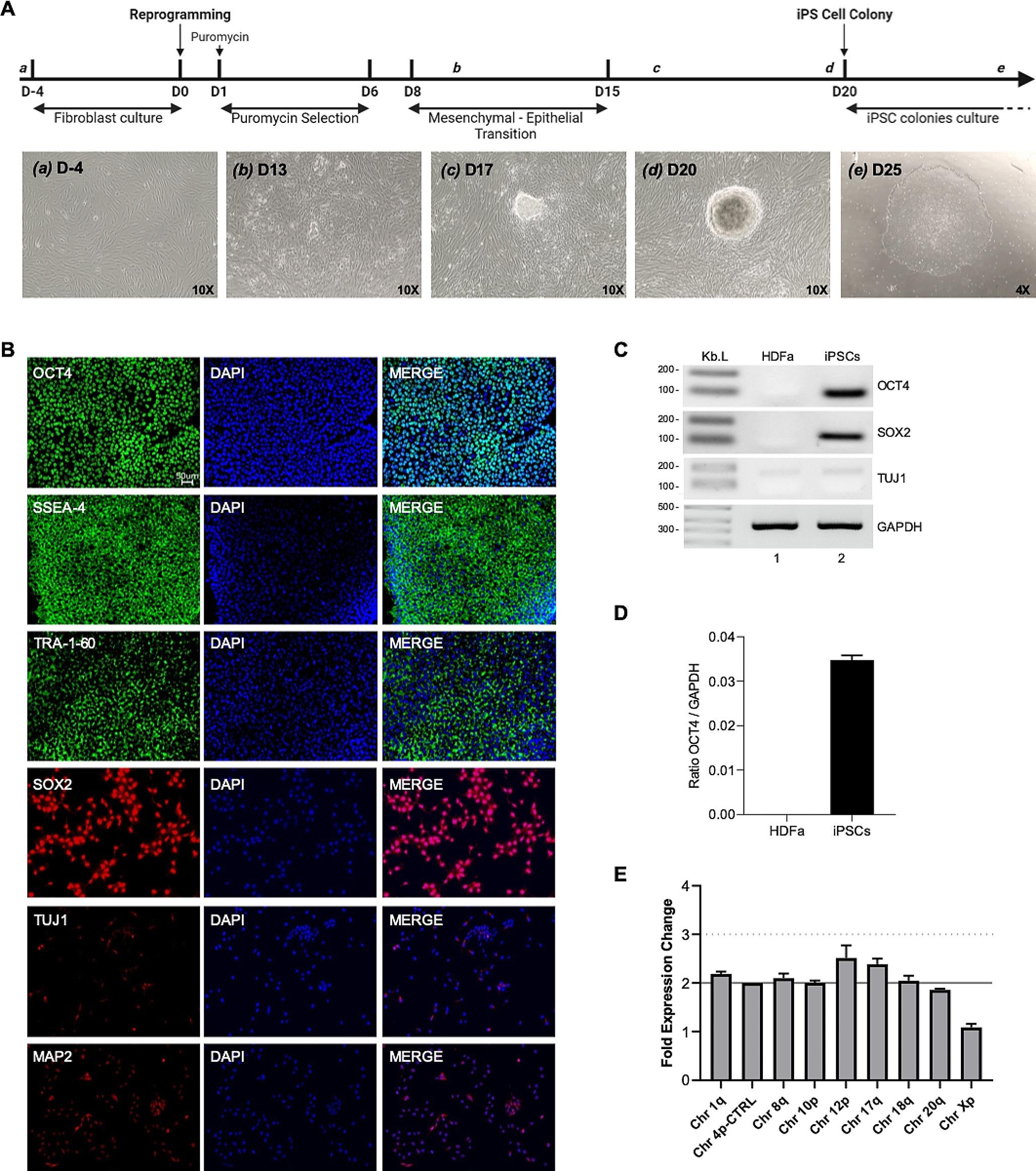 Modeling HIV-1 infection and NeuroHIV in hiPSCs-derived cerebral organoid cultures