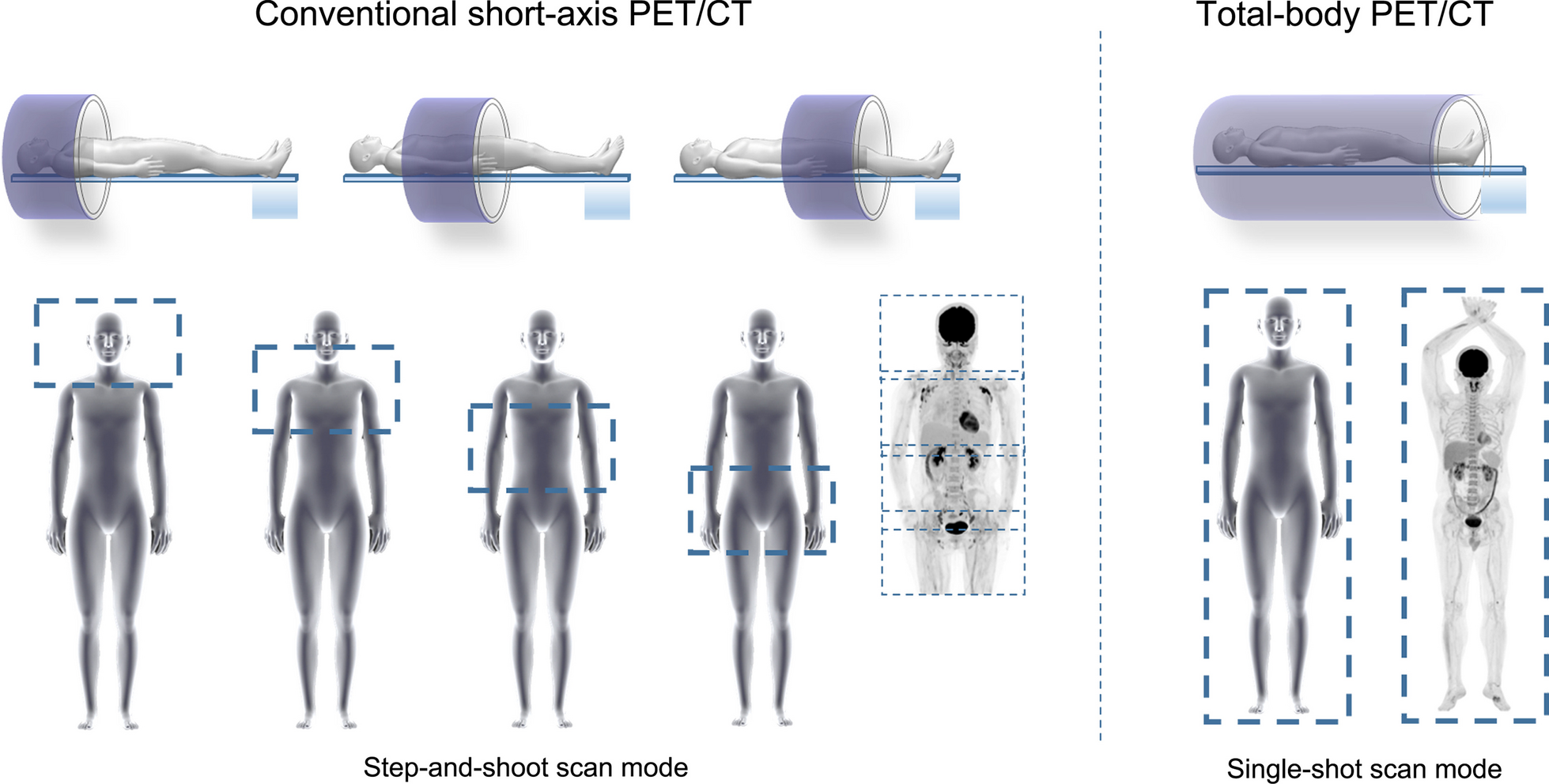 Performance and application of the total-body PET/CT scanner: a literature review