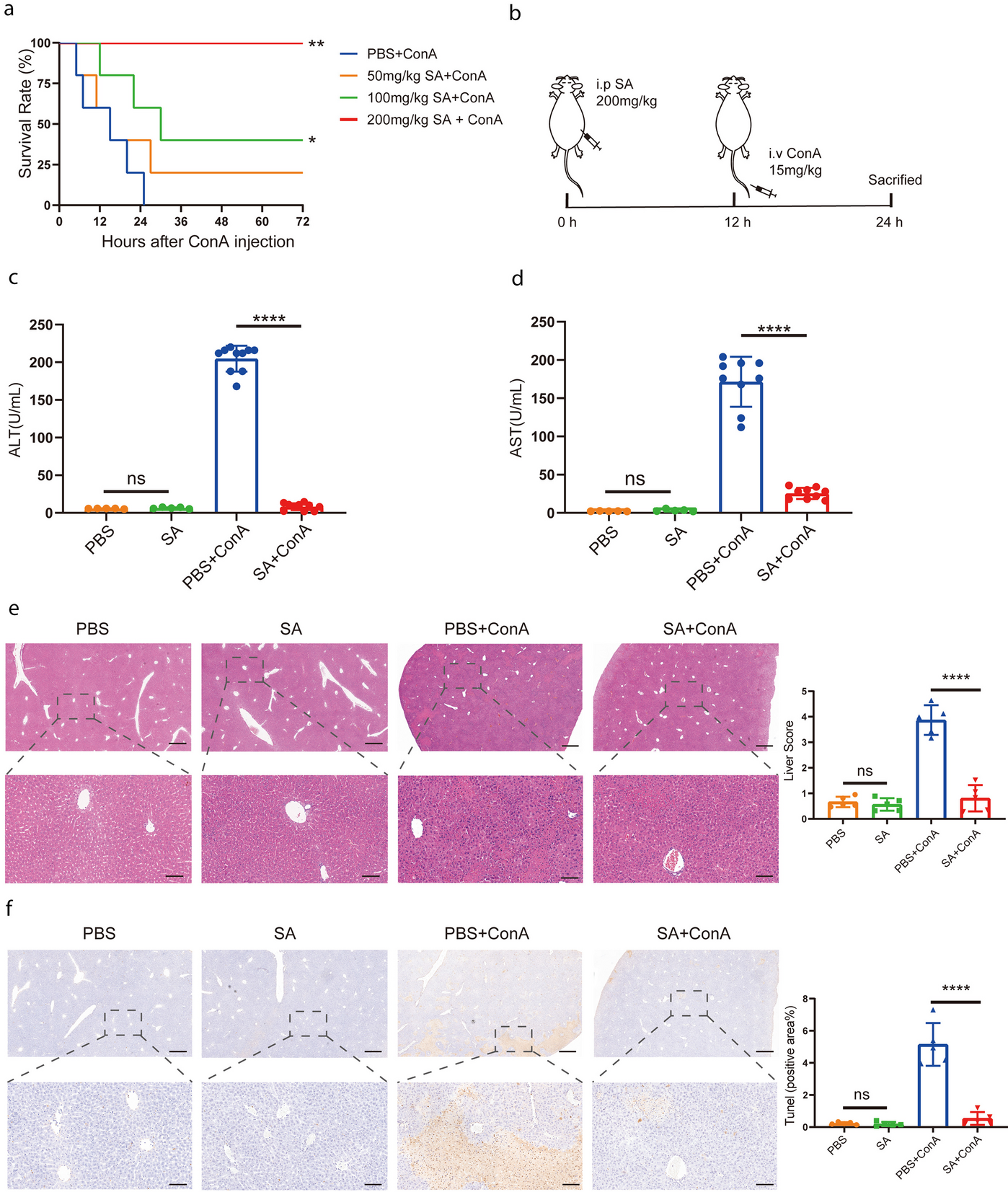 Succinic Acid Ameliorates Concanavalin A-Induced Hepatitis by Altering the Inflammatory Microenvironment and Expression of BCL-2 Family Proteins