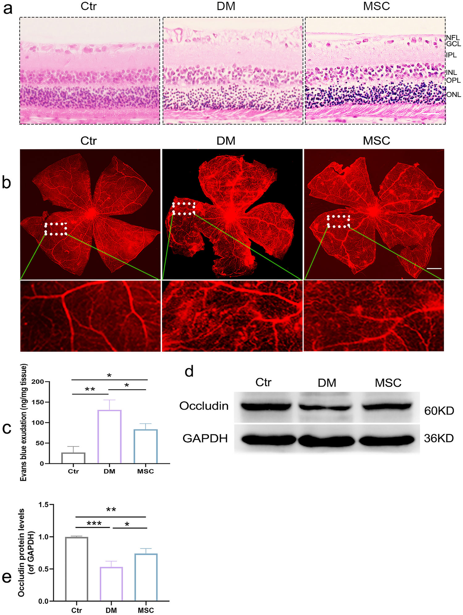 Mesenchymal Stem Cells Regulate Microglial Polarization via Inhibition of the HMGB1/TLR4 Signaling Pathway in Diabetic Retinopathy