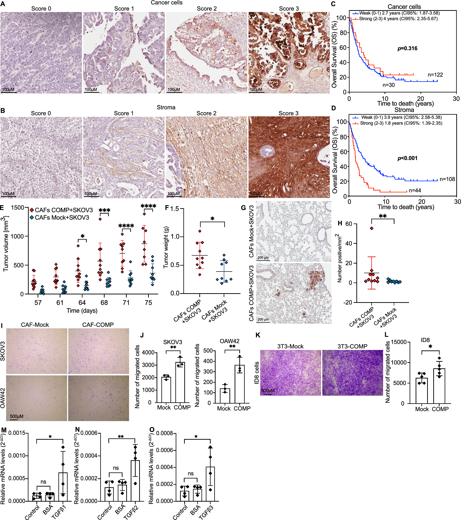 Stromal cartilage oligomeric matrix protein as a tumorigenic driver in ovarian cancer via Notch3 signaling and epithelial-to-mesenchymal transition
