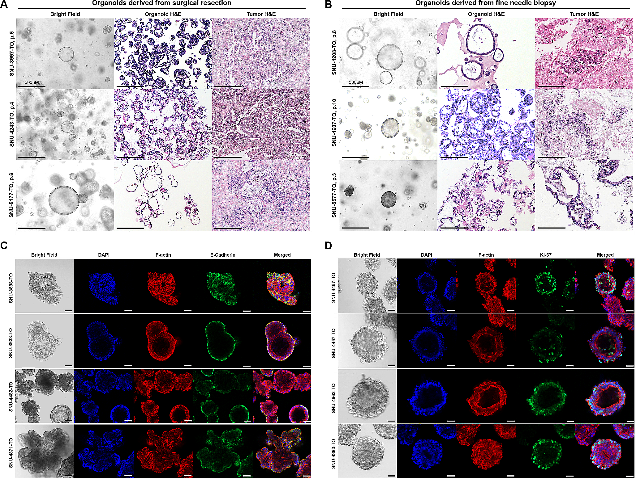 Establishment, characterization, and biobanking of 36 pancreatic cancer organoids: prediction of metastasis in resectable pancreatic cancer