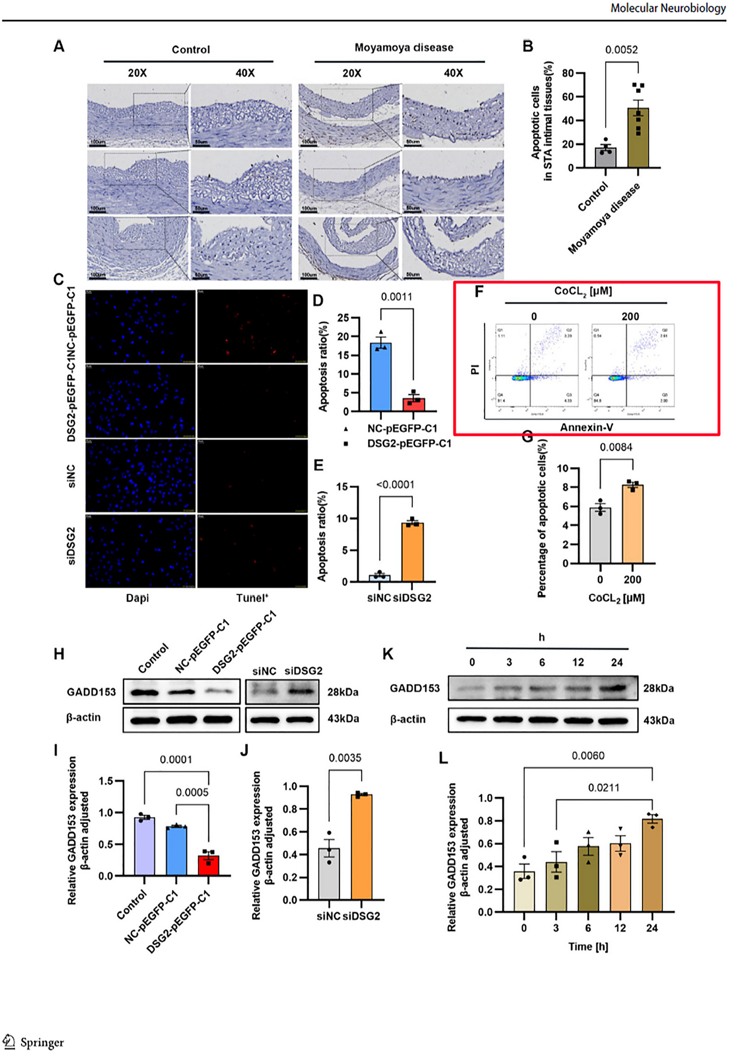 Correction: Desmoglein-2 Affects Vascular Function in Moyamoya Disease by Interacting with MMP-9 and Influencing PI3K Signaling