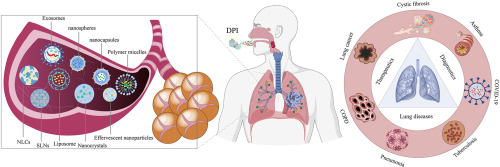 “Nano-in-Micro” Structured Dry Powder Inhalers for pulmonary delivery: Advances and challenges
