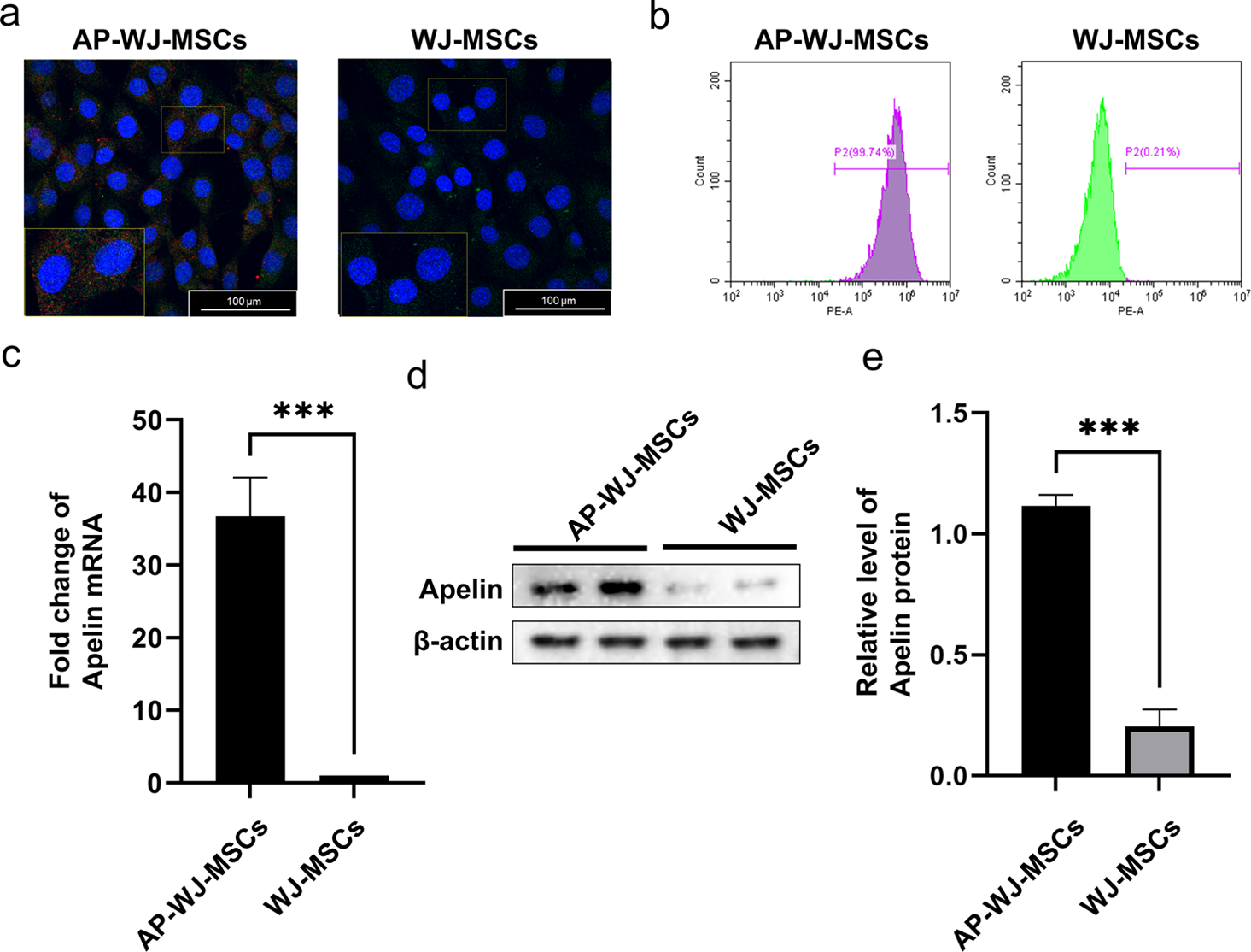 Enhancing insulin sensitivity in type 2 diabetes mellitus using apelin-loaded small extracellular vesicles from Wharton’s jelly-derived mesenchymal stem cells: a novel therapeutic approach