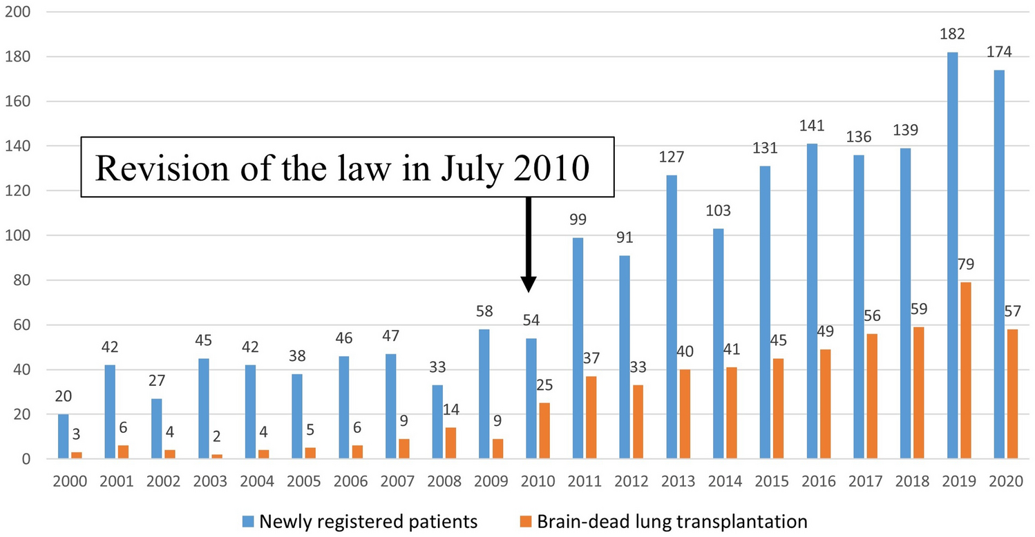 Effect of revised organ transplant law in Japan on lung transplantation