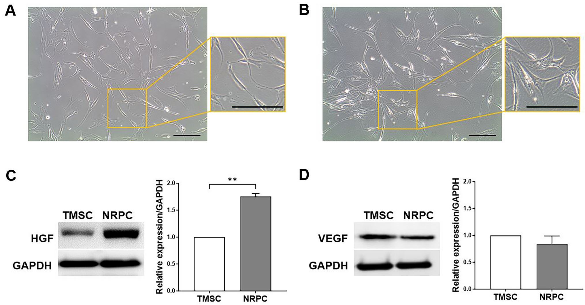 Therapeutic Effect of Schwann Cell-Like Cells Differentiated from Human Tonsil-Derived Mesenchymal Stem Cells on Diabetic Neuropathy in db/db Mice