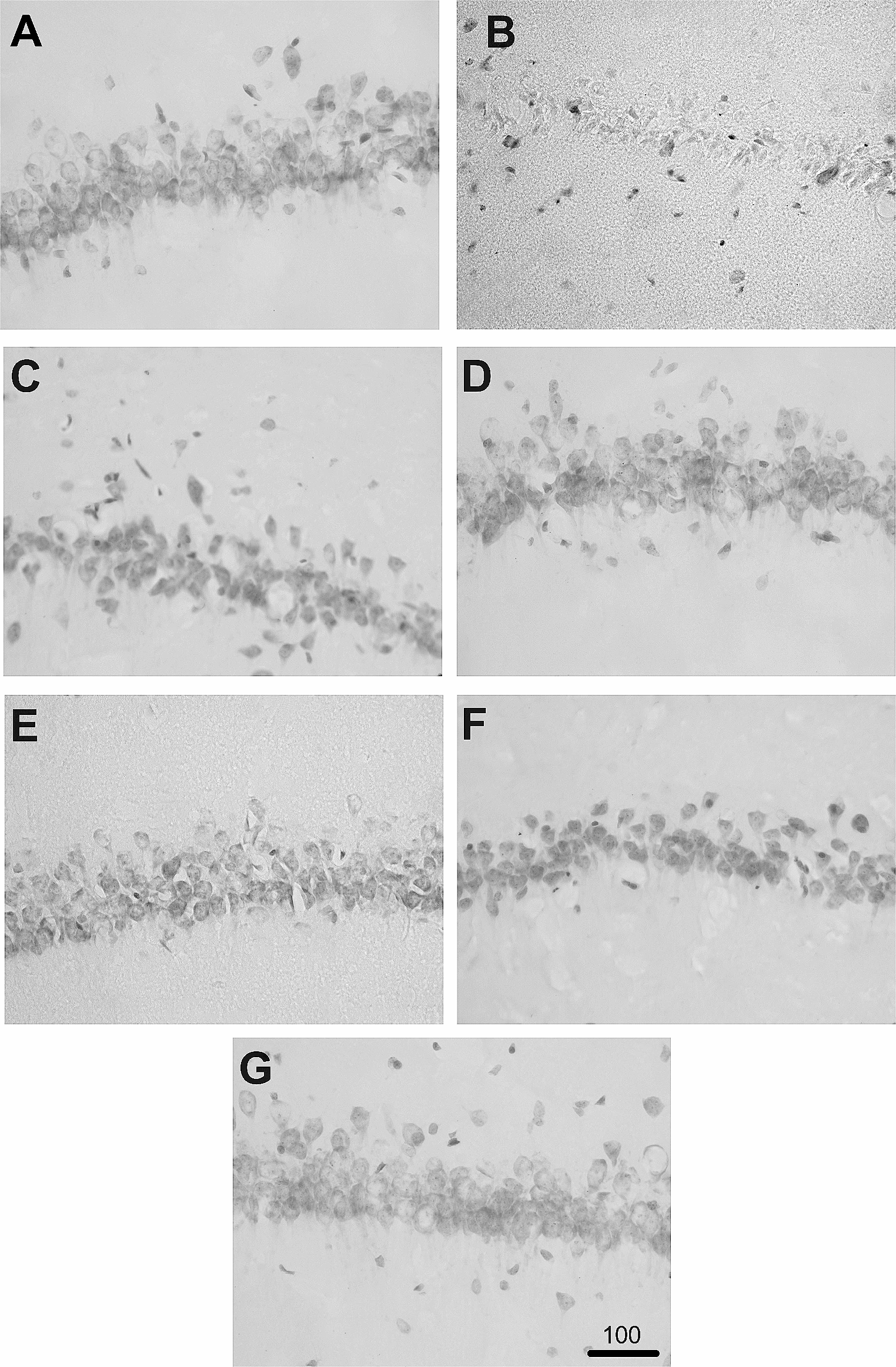 Synergistic neuroprotective action of prolactin and 17β-estradiol on kainic acid-induced hippocampal injury and long-term memory deficit in ovariectomized rats