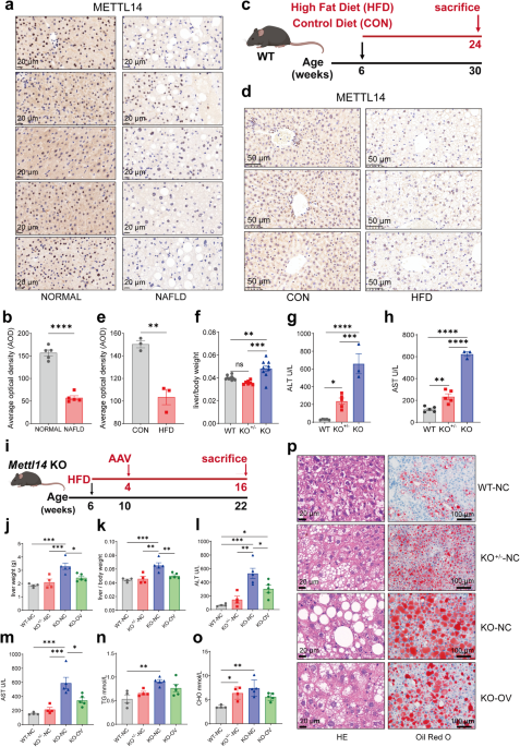 METTL14 downregulation drives S100A4+ monocyte-derived macrophages via MyD88/NF-κB pathway to promote MAFLD progression