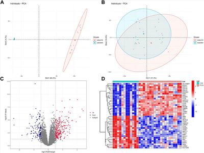 Identification of immune-related biomarkers for glaucoma using gene expression profiling