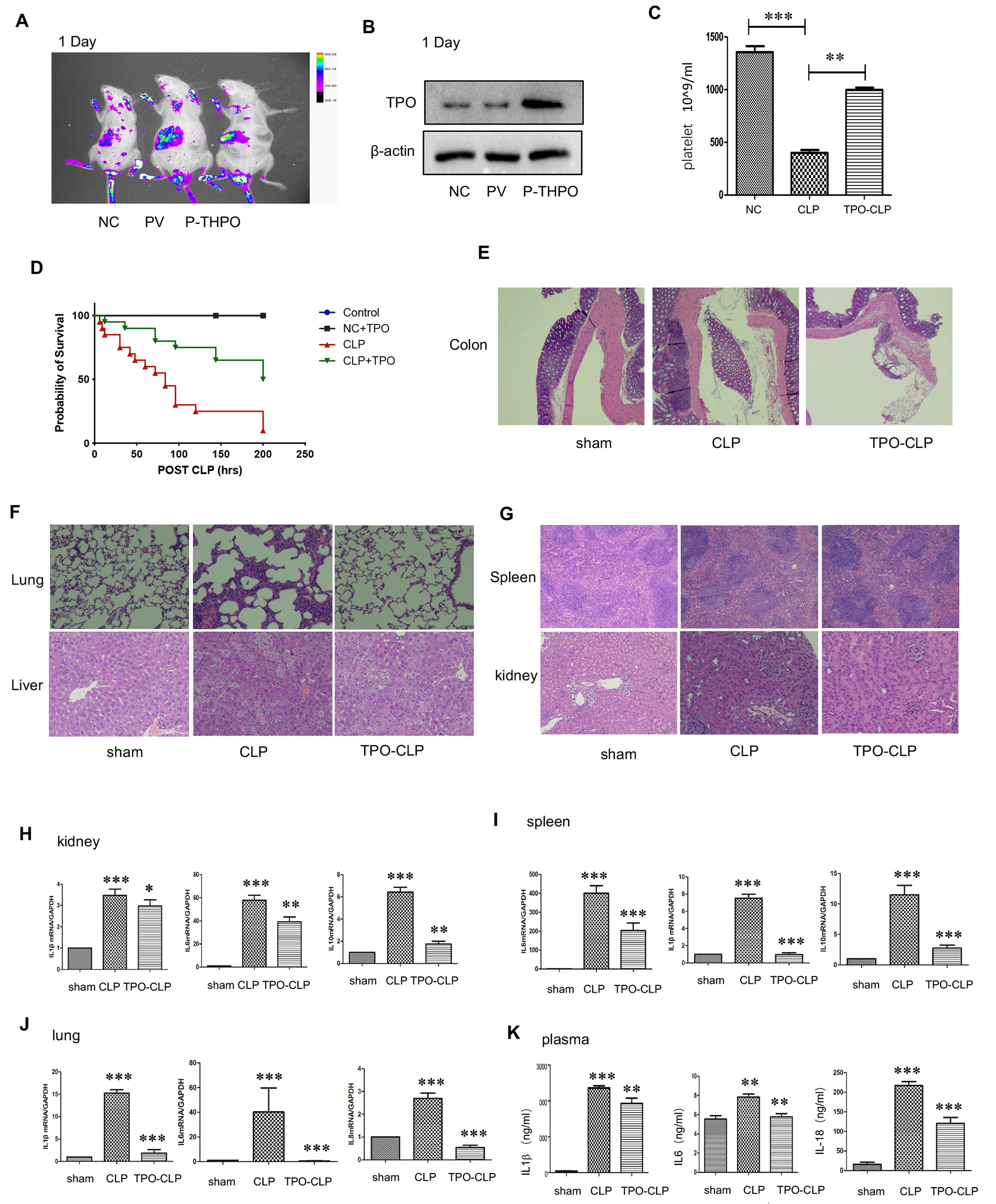 EGFR of platelet regulates macrophage activation and bacterial phagocytosis function