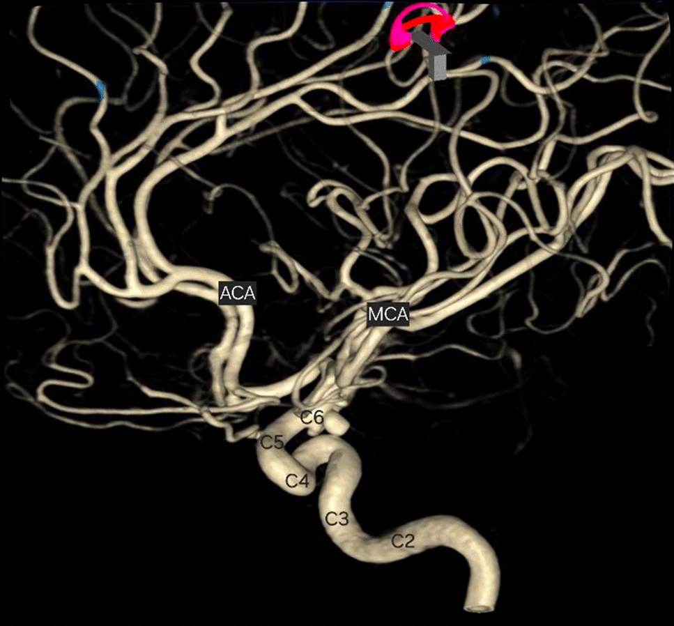 A primer to vascular anatomy of the brain: an overview on anterior compartment