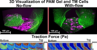 Comparative Analysis of Traction Forces in Normal and Glaucomatous Trabecular Meshwork Cells within a 3D, Active Fluid-Structure Interaction Culture Environment
